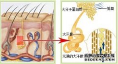 大连生活中腋臭患者需要注意什么