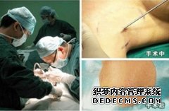 大连腋臭手术前患者可以自行剔除腋毛吗