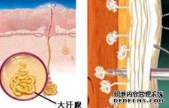 大连青少年轻度狐臭要怎么办